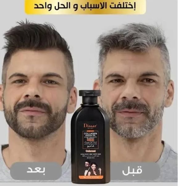 شامبو القضاء على الشيب