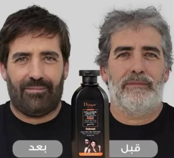 شامبو القضاء على الشيب