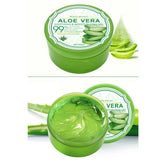 ALOE VERA علاج حب الشباب