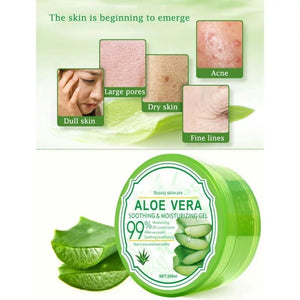 ALOE VERA علاج حب الشباب