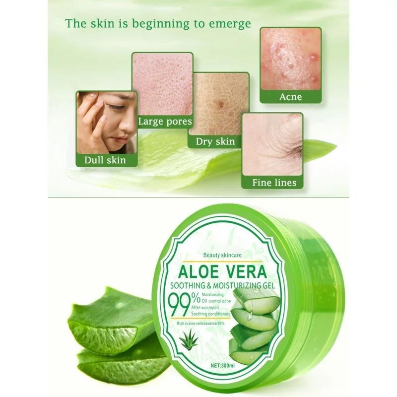 ALOE VERA علاج حب الشباب